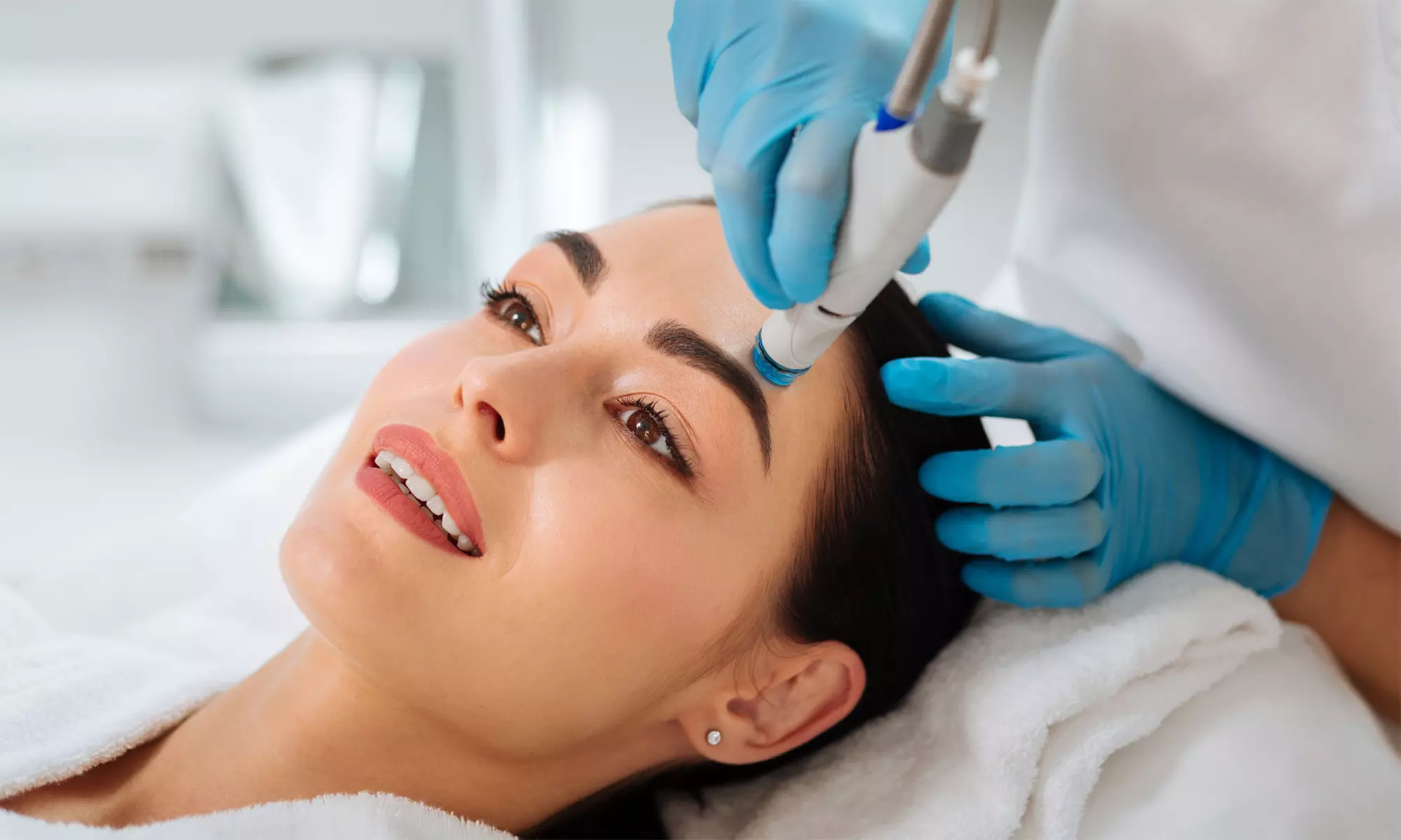 Strahlende Haut in 90 Min: Microneedling o. BB Glow für frischen Teint