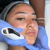 Image 7: Advanced Micro-needling w/ Luxury Hydrating Serums - Face and/or Neck