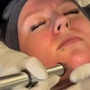 Image 2: Revitalize Your Skin with a Soothing HydraFacial Treatment