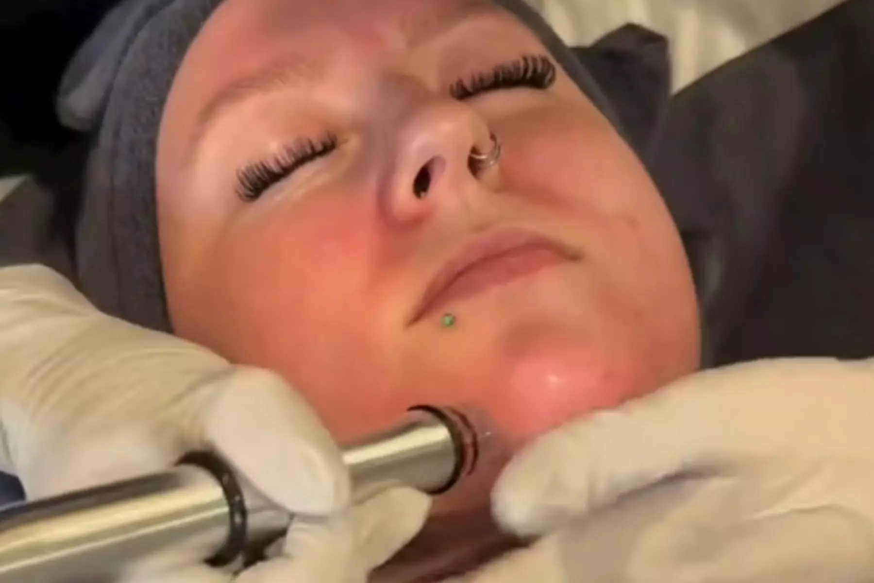 Revitalize Your Skin with a Soothing HydraFacial Treatment