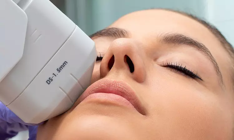 Sesión de HIFU facial 7D con opciones personalizadas para tratar rostro completo, cuello o zona a elegir - Primary Image