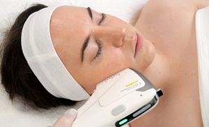 12D HIFU Treatment at Glow Enhancements 