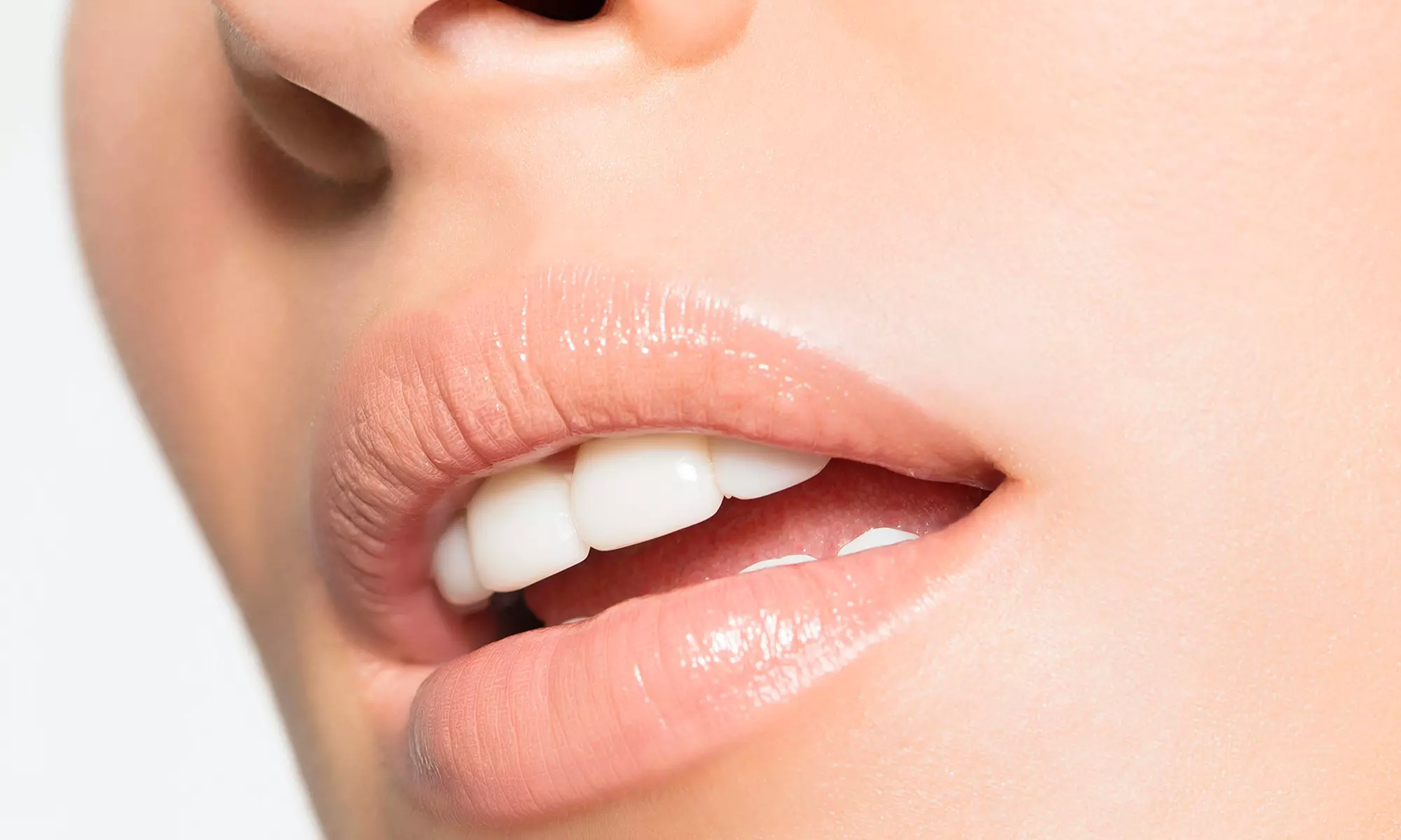 Lip Flip or Lip Filler Treatment at Skinovatio - Arlington Heights (Up To 35% Off) - Primary Image