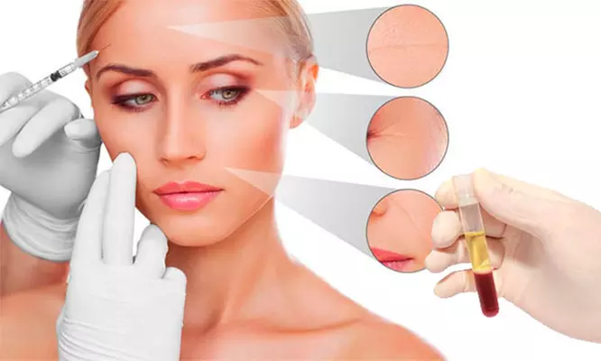 One Non-Surgical PRP Facelift Session at Injection Studio (Up to 52% Off) - Primary Image
