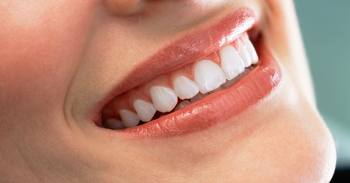 Limpieza dental y blanqueamiento LED en Tetuán, Madrid