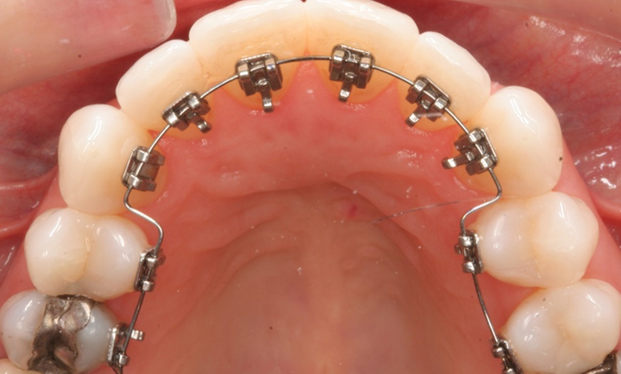 Image 4: Cosmetic Dentistry Consultation