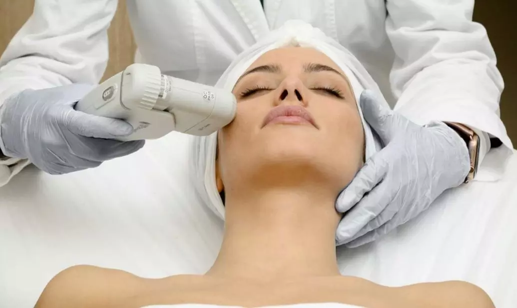 1 sesión de tratamiento de lifting facial HIFU para 1 persona