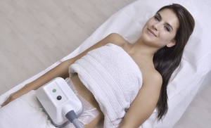 Cryolipolysis Fat Freezing on Two Areas at Vibration Cafe, 4 Locations