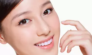 20 or 40 Units of Botox + Free Consultation at Pure Med Spa