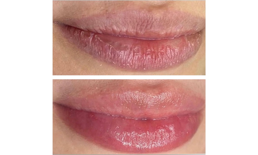 Image 8: Hydrating Lip Drip Treatment with/without Color Boost