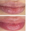 Image 8: Hydrating Lip Drip Treatment with/without Color Boost
