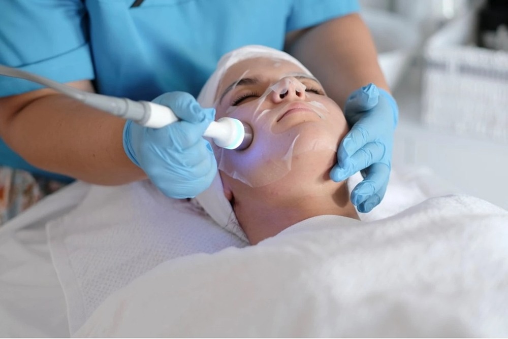 Bis zu 58% Rabatt auf den Micro-Needling bei Raquel's Beauty