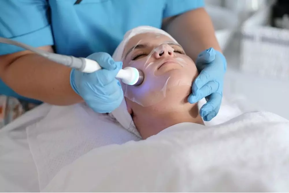 Bis zu 58% Rabatt auf den Micro-Needling bei Raquel's Beauty - Primary Image