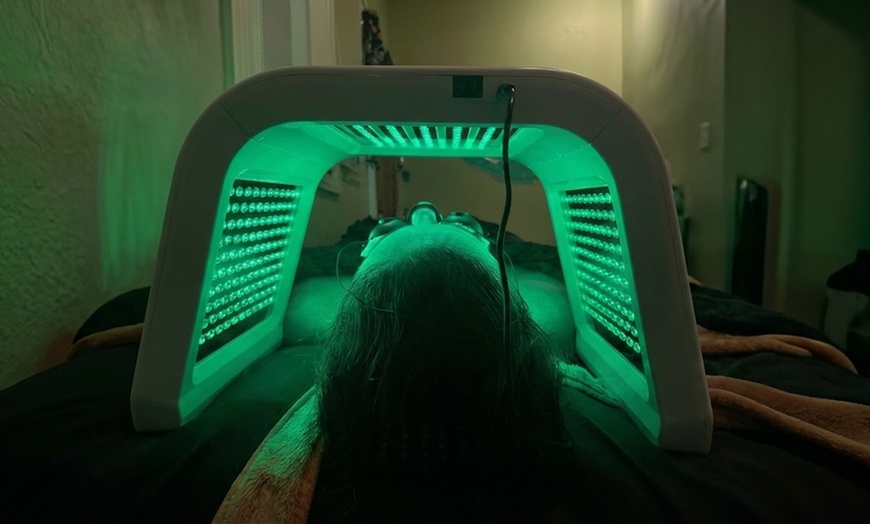 Image 2: 50-Min Brightening Facial or 1 or 2 Microdermabrasion Facial Sessions