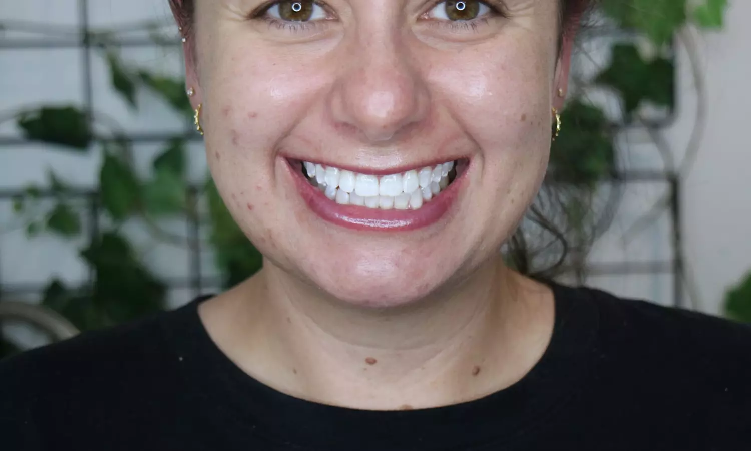 Premium 60-Minute Teeth Whitening at Smile Labs Penrith