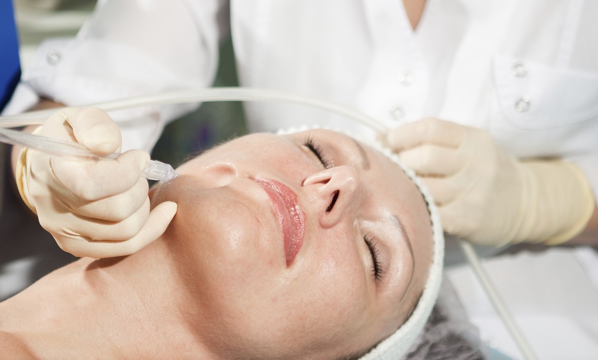 Image 1: Chemical Peel Facial - One or Three Sessions