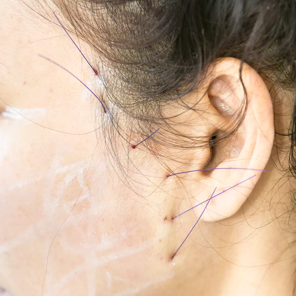Up to 75% Off on PRP Hair Restoration - Non-Surgical at MD Cosmetic Clinic


 - Second Medium