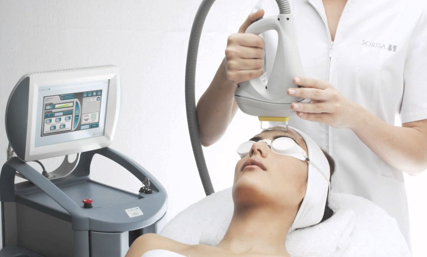 Image 2: IPL Treatments, 2 Locations