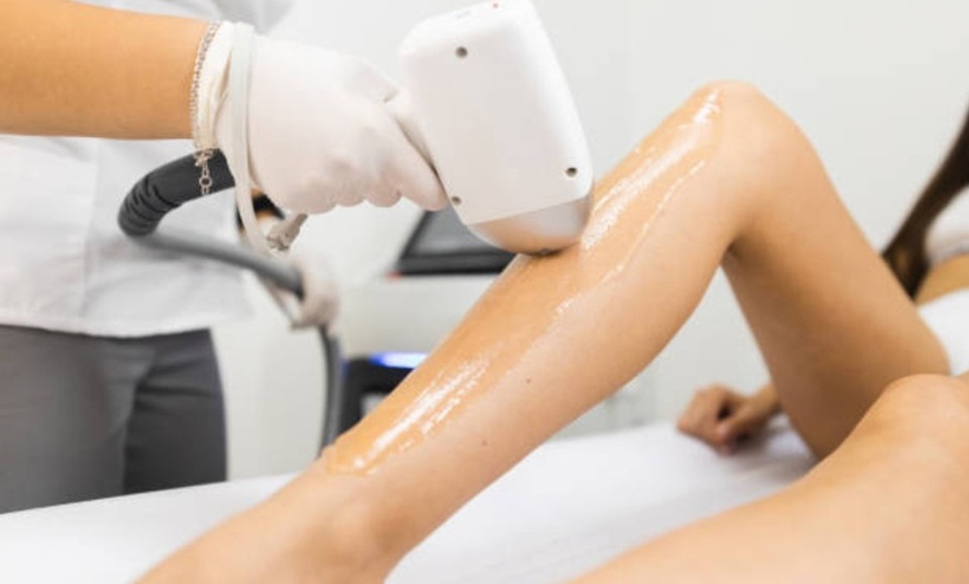 Image 9: 1, 3 o 5 sesiones de depilación con láser de diodo en zona a elegir