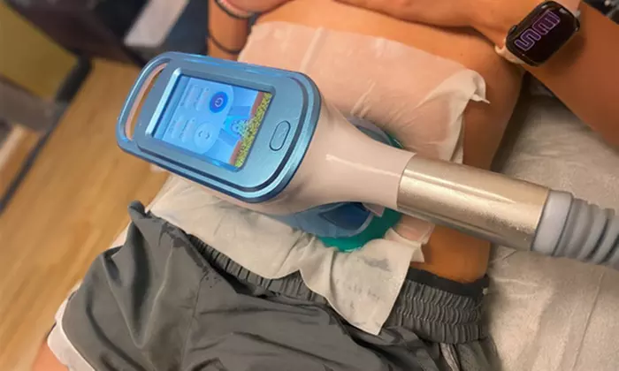 Cryolipolysis Fat-Freezing: 1, 2, 3 or 6 Treatments on Areas of Choice