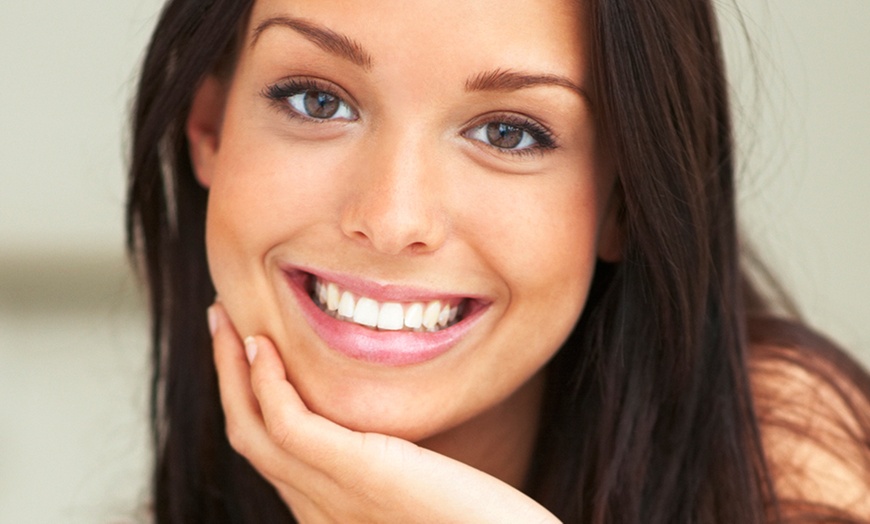 Teeth Whitening Session - Iconic Smile | Groupon