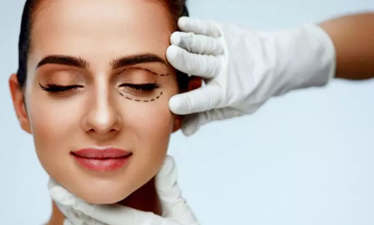 Blefaroplastia térmica