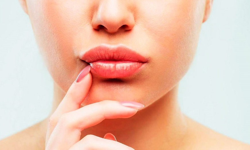 Image 4: Infiltración para aumento de labios o en zona a elegir de 1ml 