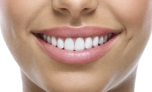 40-Min In-Chair Teeth Whitening