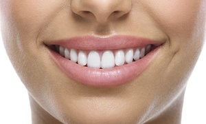 40-Min In-Chair Teeth Whitening