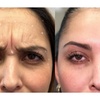 Image 3: Up to 37% Off on Injection - Botox at Metamorph Med Spa
