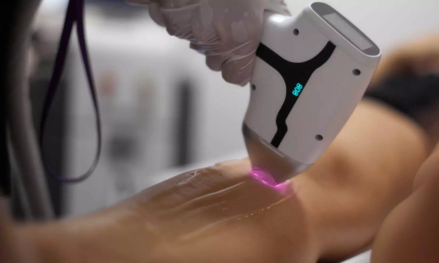 5 séances d'épilation au laser des aisselles avec Dépiléo Herrlisheim