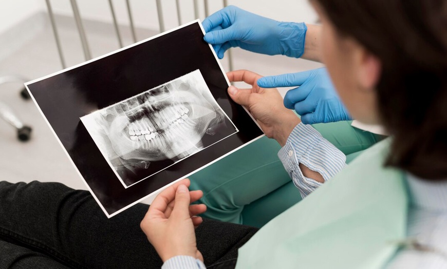 Image 8: Limpieza bucal con radiografía y opción a curetaje de 1 o 2 arcadas