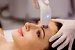 Micro Dermabrasion, Hydra Facials, Light Therapy and More at Infinity Skin Care Clinic(Up to 75% Off) - Second Medium
