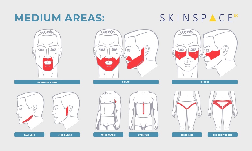 Image 5: Three or Six Sessions of Laser Hair Removal at SkinSpaceUK