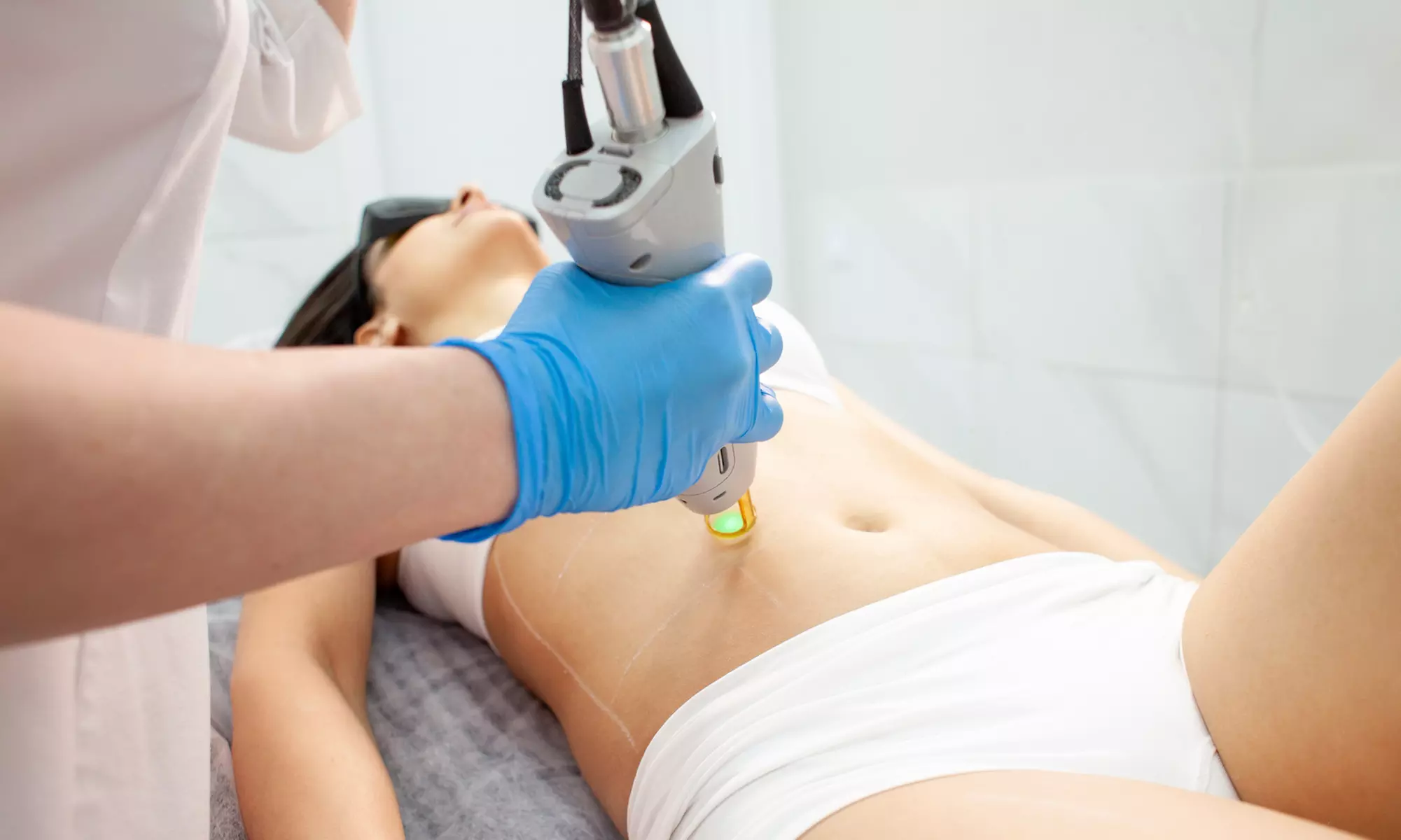 Six Laser Hair Removal Sessions at VIP Med Spa and Weight Solutions (Up to 74% Off) - Primary Image