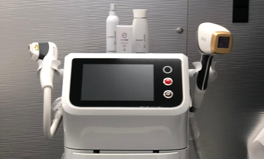 Image 3: Haarentfernung mit Diodenlaser an 1 Zone nach Wahl für 1 Person