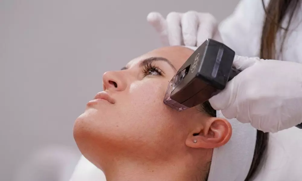 Advanced Morpheus8 & PRP Micro needling for Deep Skin Remodeling