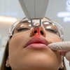 Image 1: Lip Laser Rejuvenation with/wihtout Hyaluronic Acid Filler Options