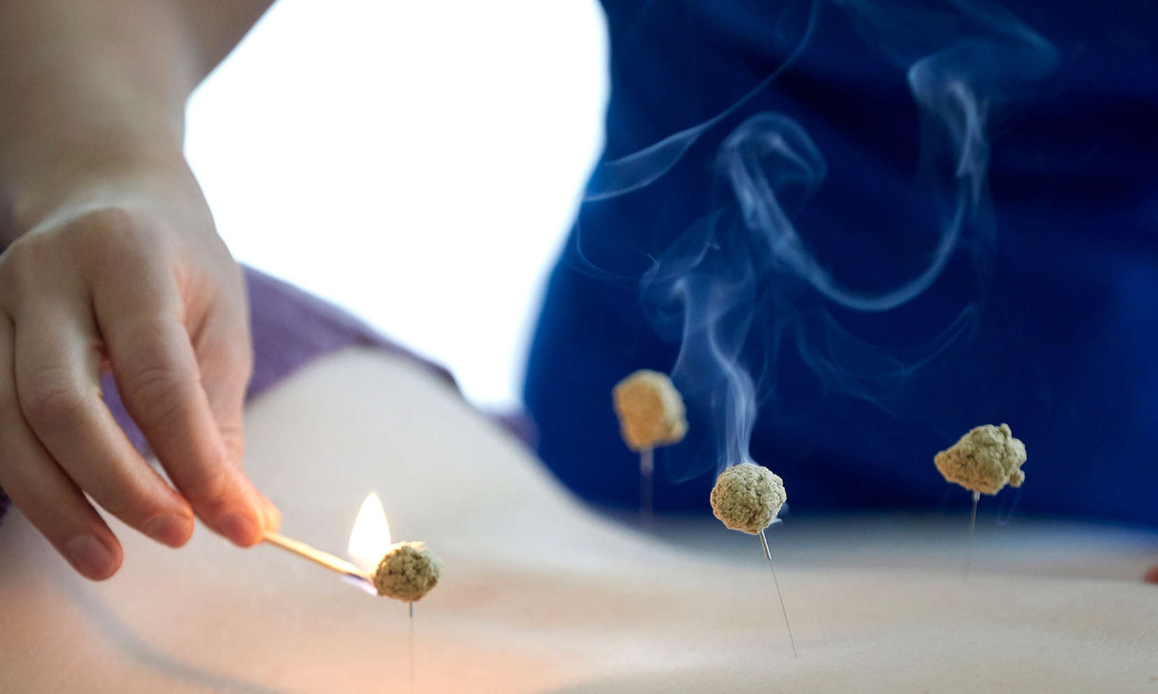 Bis zu 56% Rabatt auf den Akupunktur bei Naturheilpraxis Salgueiro