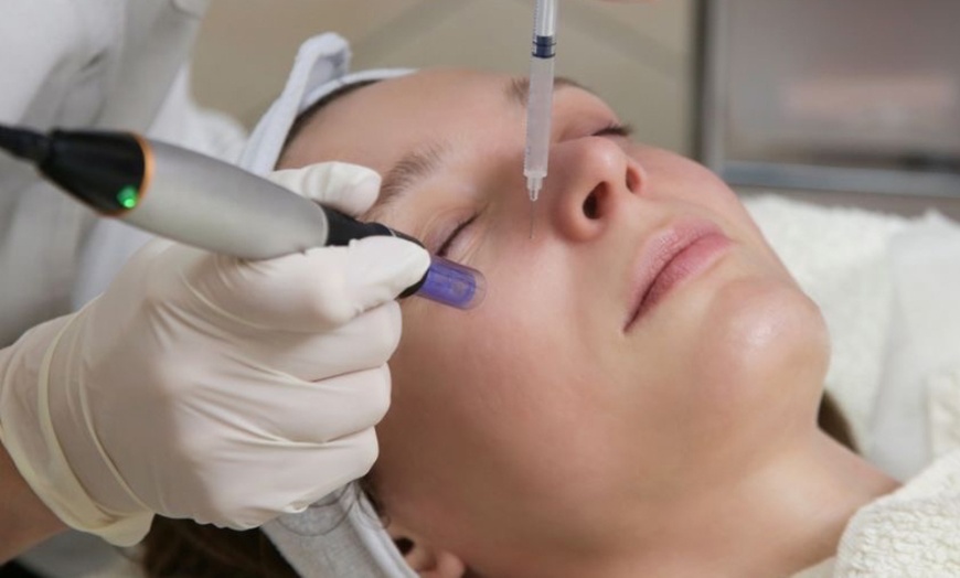 Image 2: Awaken Your Skin’s Natural Power: PRP Facial + Microneedling at Renova Med Spa