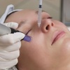 Image 2: Awaken Your Skin’s Natural Power: PRP Facial + Microneedling at Renova Med Spa