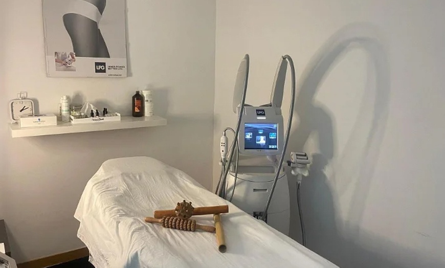 Image 5: 1 o 2 sesiones de exosomas con dermapen en 2 fases en rostro completo