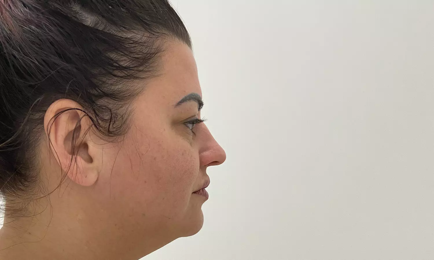 Facial Treatments at True Dream Beauty Bar (Up to 30% Off) - Second Medium