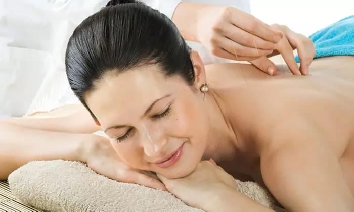 Discover Liferoot Acupuncture's healing with up to 31% off, offering treatments and nutritional guidance. - Primary Image
