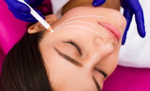 Enhance Your Look w/ 10 PDO Thread Lifts at Radiant Beauty and Health!