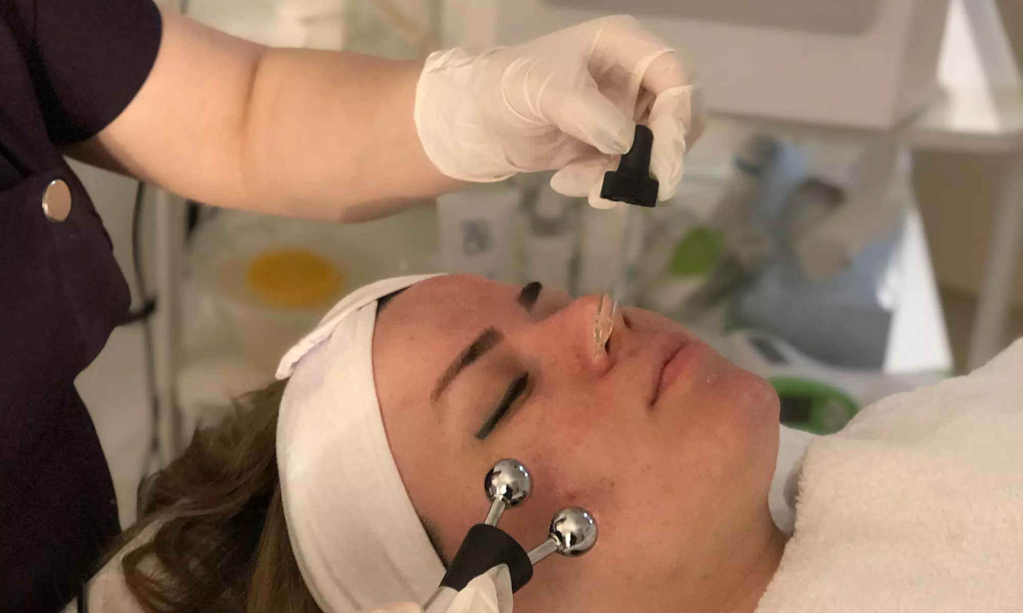 Face Microdermabrasion
