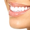 Image 1: Up to 63% Off on Teeth Whitening - In-Office - at Modern Smile