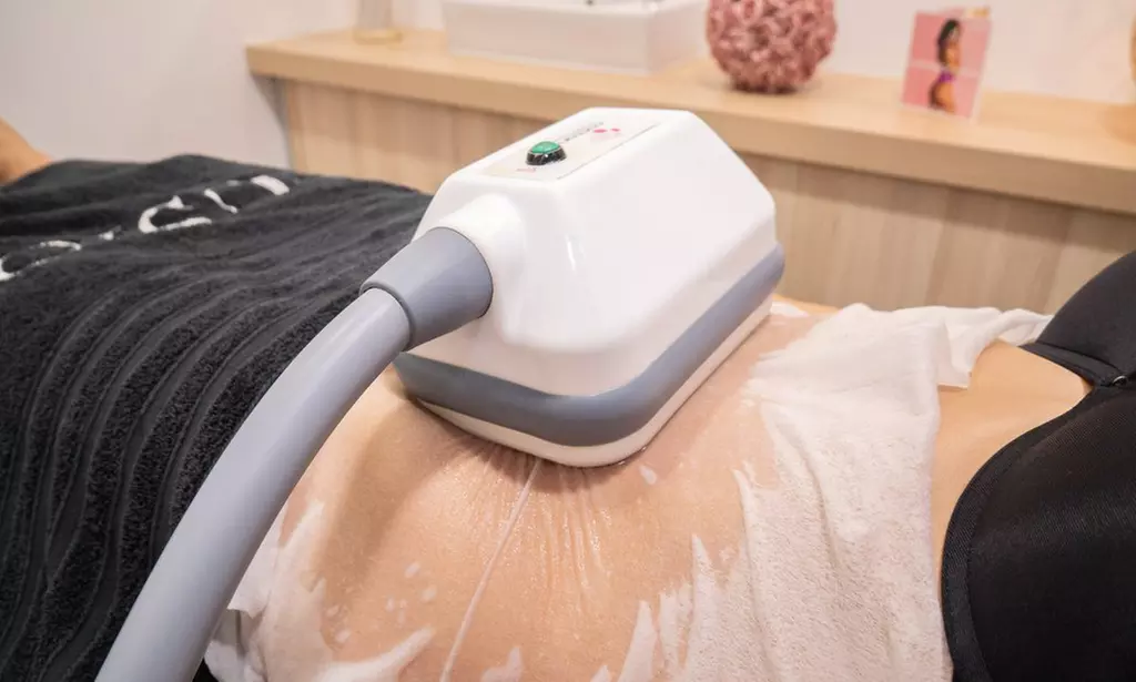 1 o 2 sesiones de criolipolisis en la Clínica Láser Fusión Raimundo