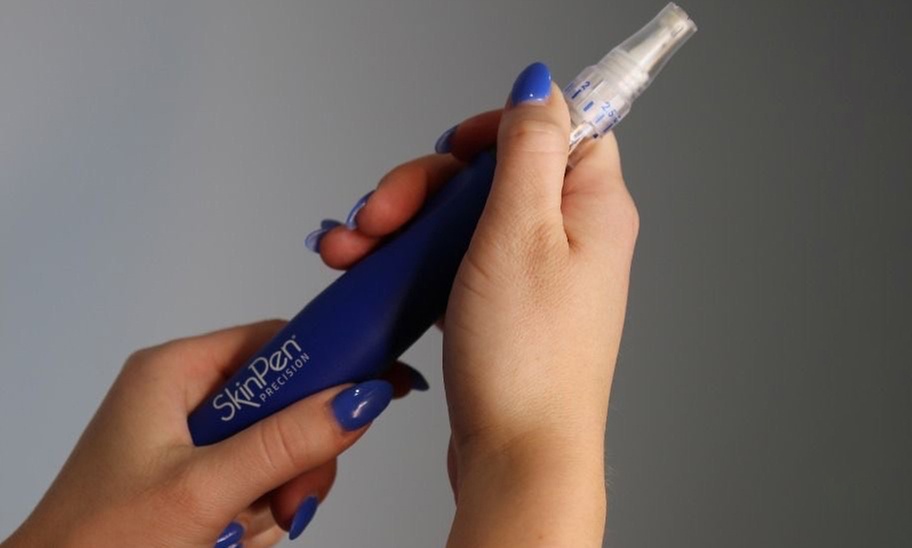 Micro-Needling Treatments for Youthful Skin Radiance