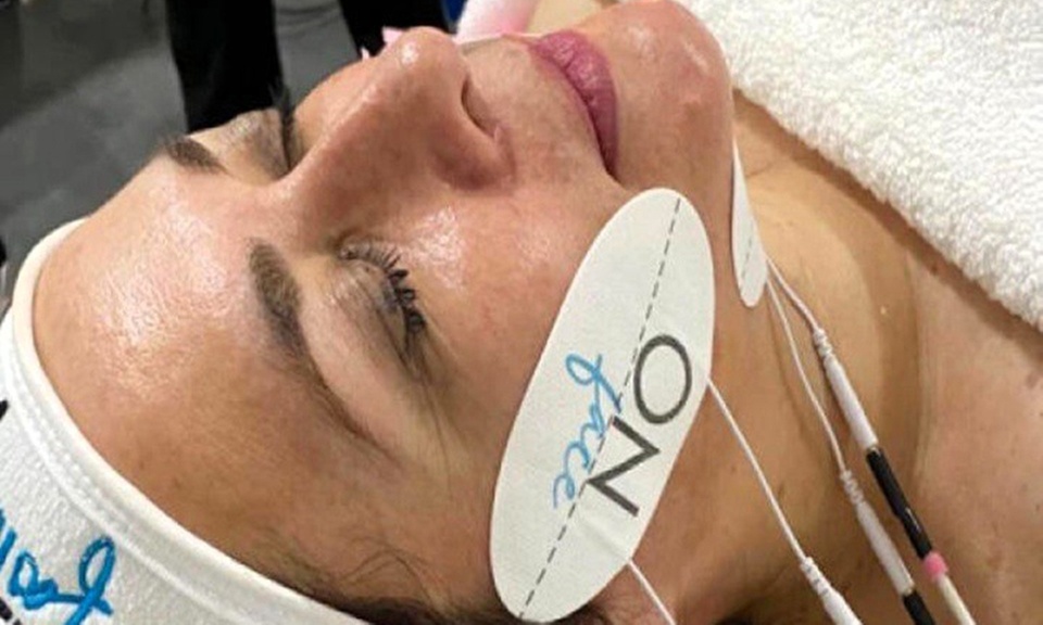 1 o 2 sesiones de lifting facial sin cirugía ON-FACE